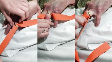 Odstranění prstenu pomocí škrtidla